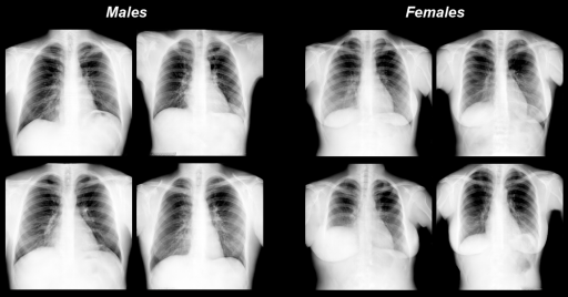 Artificial text x-ray images